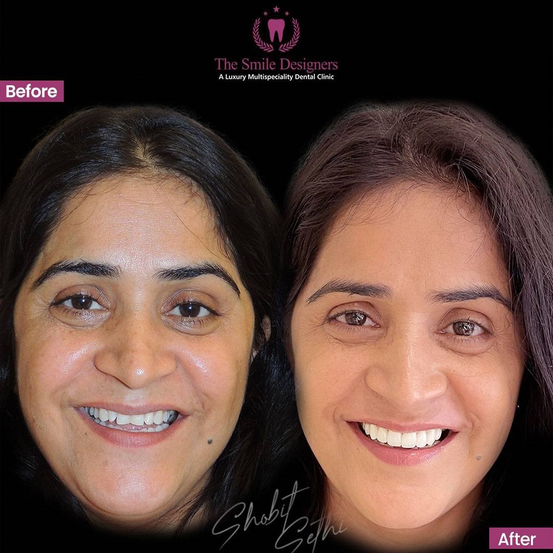 patients from USA, UK, Canada