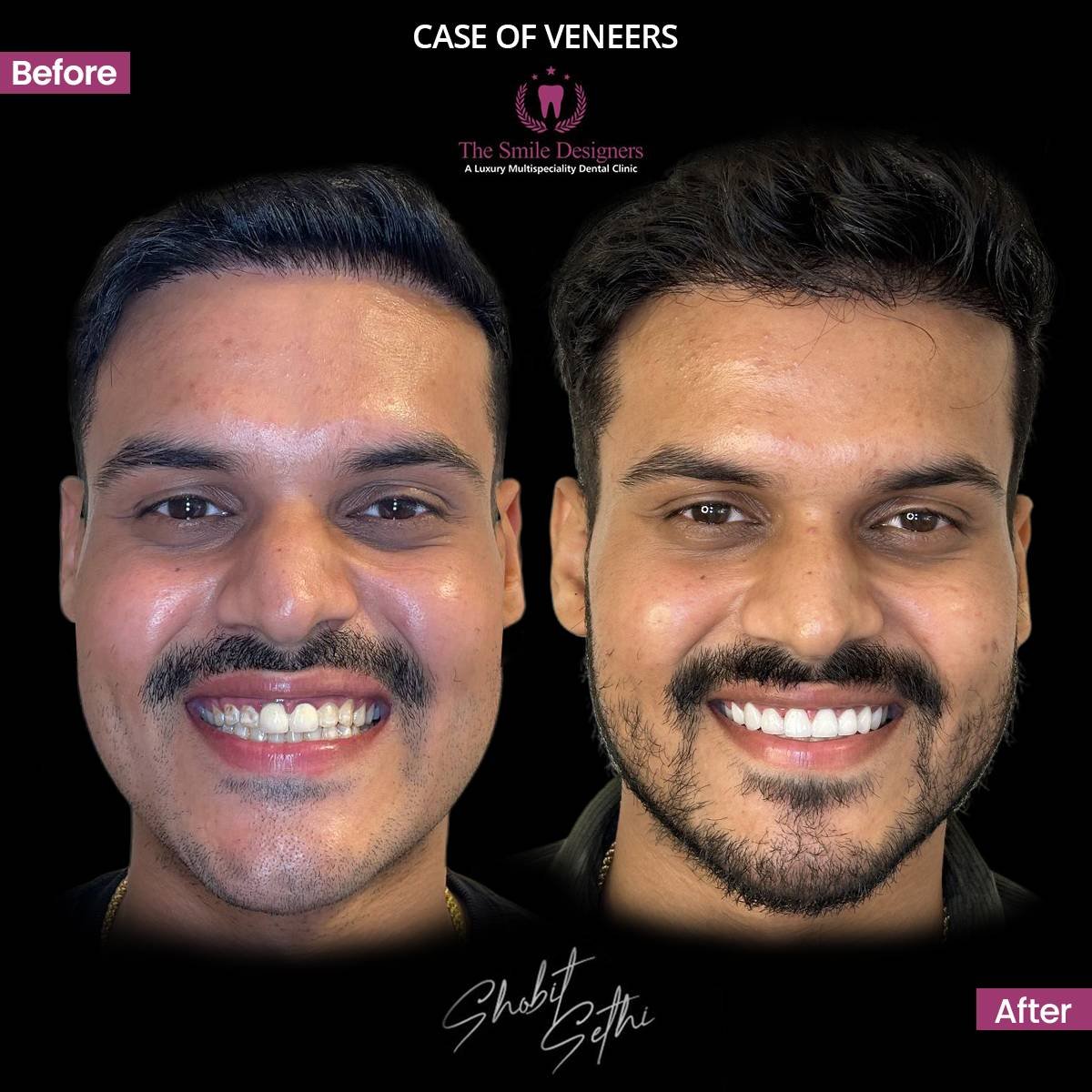 dental holiday packages in chandigarh