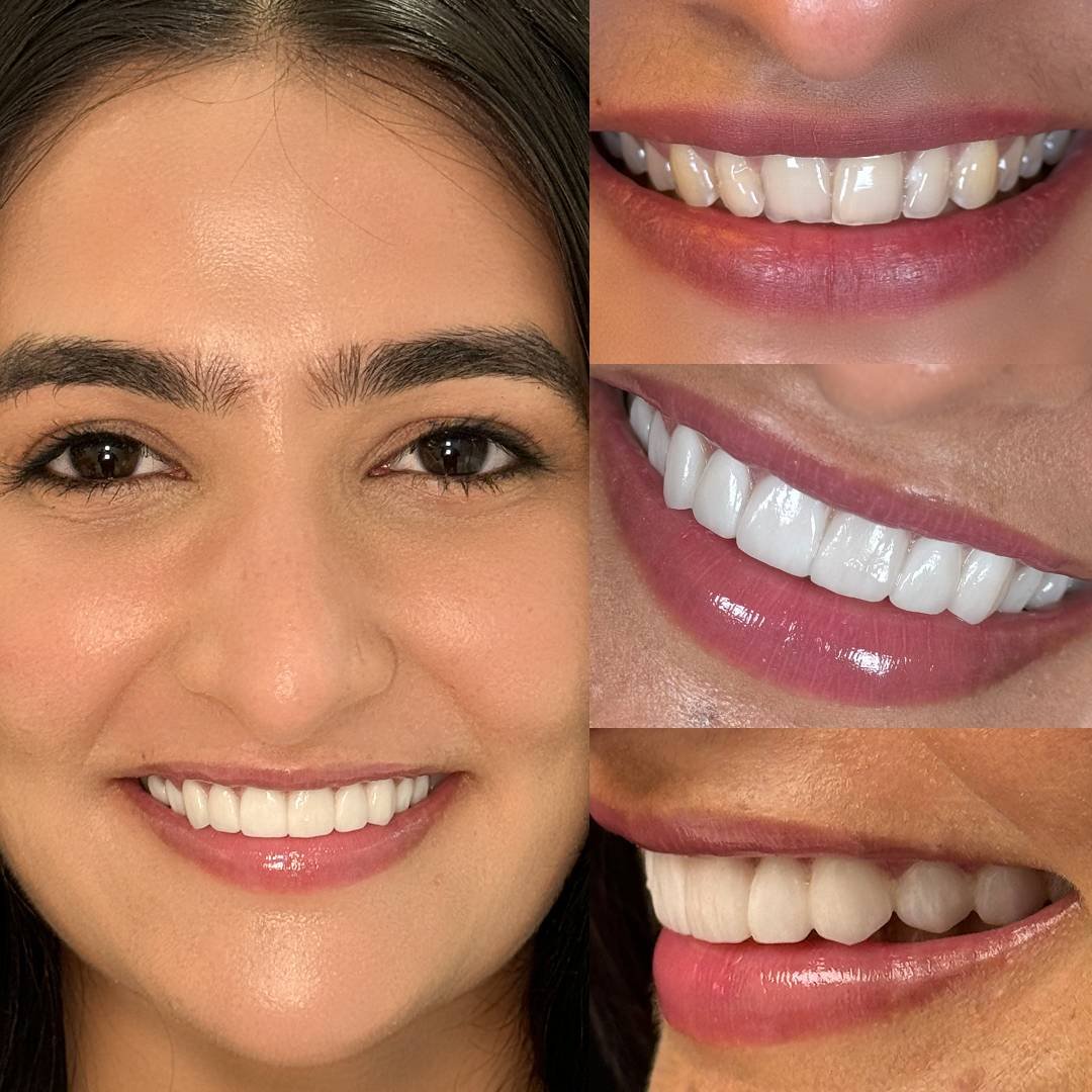 best country for dental implants