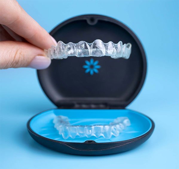 World best invisalign diamond provider in india