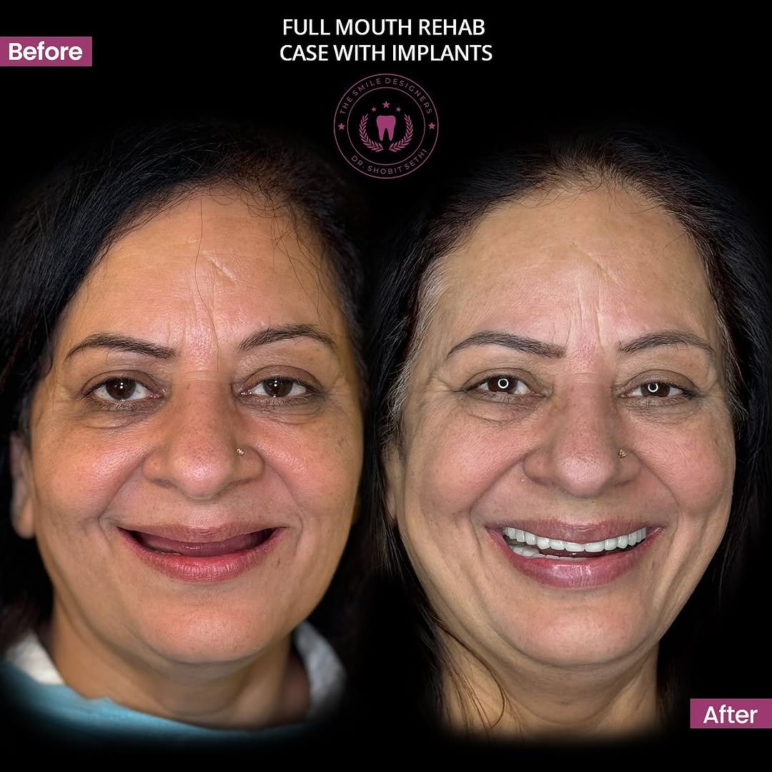 Snapinsta.app_471716720_17989037318765016_8748696861557764399_n_1080